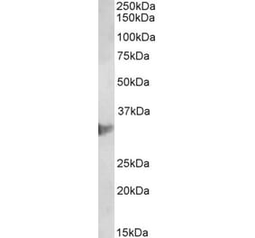 Western Blot - Anti-CLIC1 Antibody (A85189) - Antibodies.com