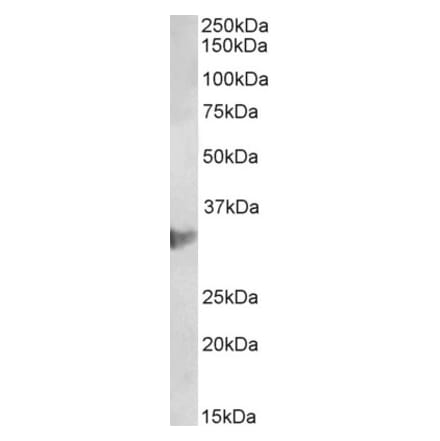 Western Blot - Anti-CLIC1 Antibody (A85189) - Antibodies.com