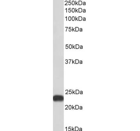 Western Blot - Anti-FLR Antibody (A85191) - Antibodies.com