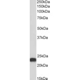 Western Blot - Anti-FLR Antibody (A85191) - Antibodies.com