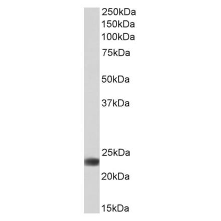 Western Blot - Anti-FLR Antibody (A85192) - Antibodies.com
