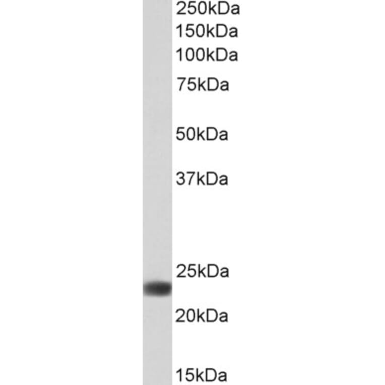 Western Blot - Anti-FLR Antibody (A85192) - Antibodies.com