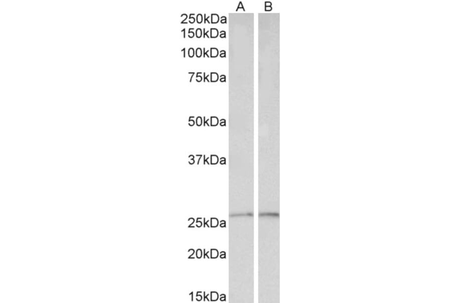 Western Blot - Anti-Peroxiredoxin 6 Antibody (A85193) - Antibodies.com