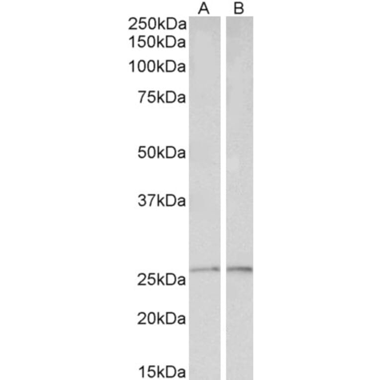 Western Blot - Anti-Peroxiredoxin 6 Antibody (A85193) - Antibodies.com
