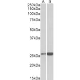 Western Blot - Anti-Peroxiredoxin 6 Antibody (A85194) - Antibodies.com