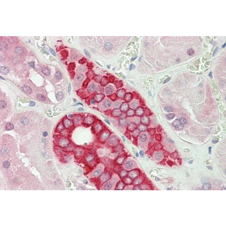 Immunohistochemistry - Anti-DDX41 Antibody (A85195)