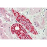 Immunohistochemistry - Anti-DDX41 Antibody (A85195)