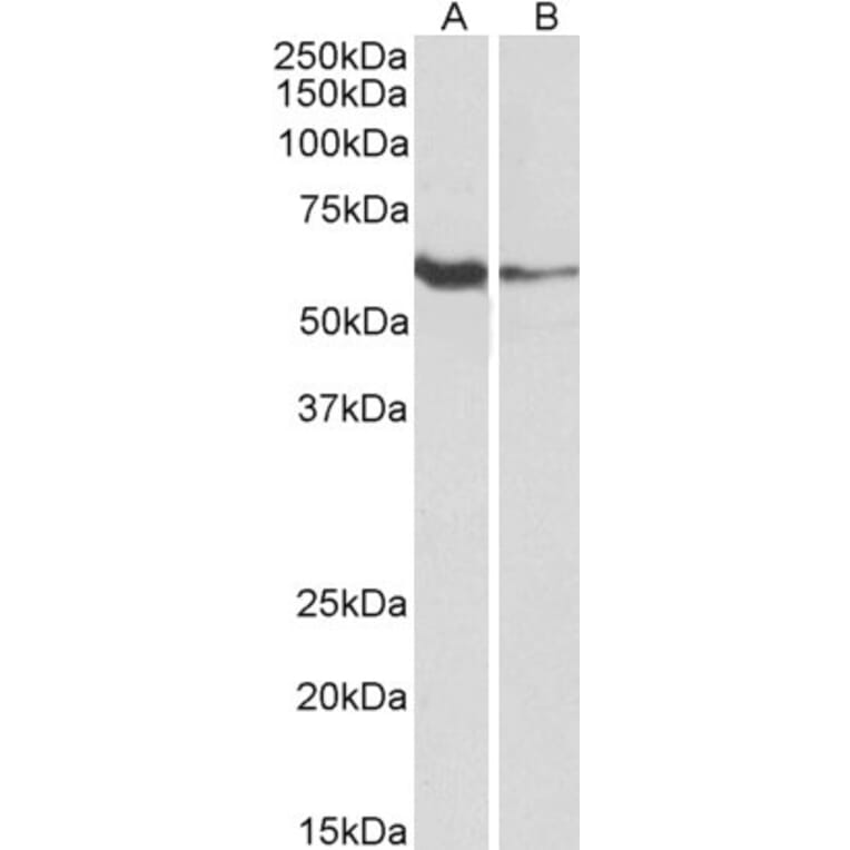 Western Blot - Anti-FCRL2 Antibody (A85198) - Antibodies.com