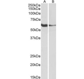 Western Blot - Anti-FCRL2 Antibody (A85198) - Antibodies.com