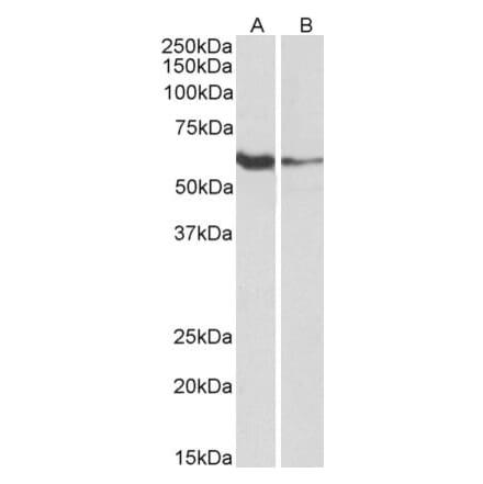 Western Blot - Anti-FCRL2 Antibody (A85198) - Antibodies.com