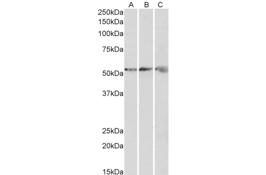 Western Blot - Anti-ATPB Antibody (A85199) - Antibodies.com