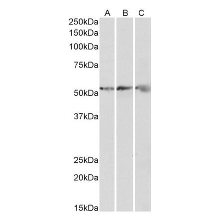 Western Blot - Anti-ATPB Antibody (A85199) - Antibodies.com