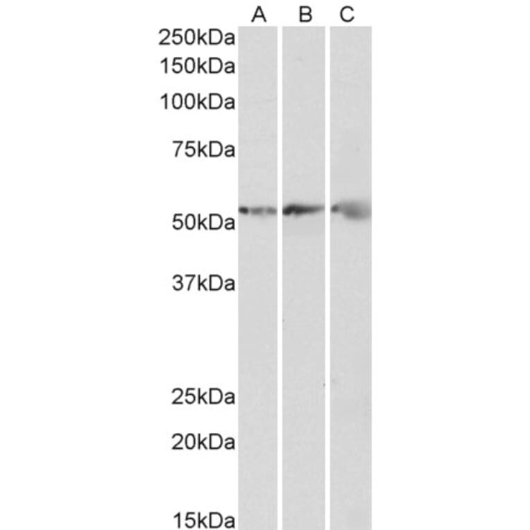 Western Blot - Anti-ATPB Antibody (A85199) - Antibodies.com