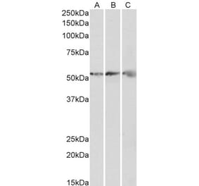 Western Blot - Anti-ATP5B Antibody (A85199) - Antibodies.com