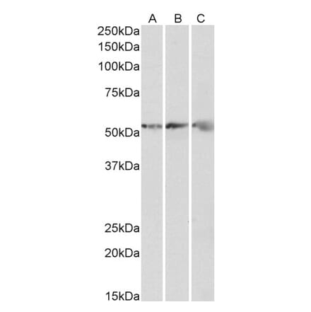 Western Blot - Anti-ATP5B Antibody (A85199) - Antibodies.com