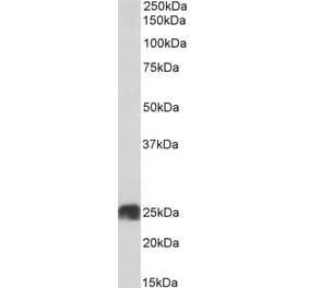 Western Blot - Anti-ATP5F1 Antibody (A85201) - Antibodies.com