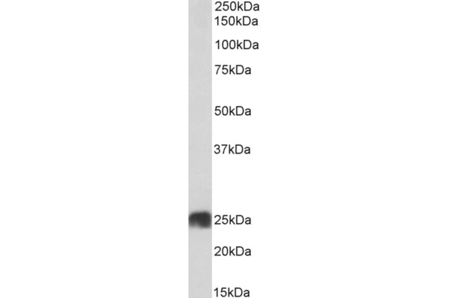 Western Blot - Anti-ATP5F1 Antibody (A85201) - Antibodies.com