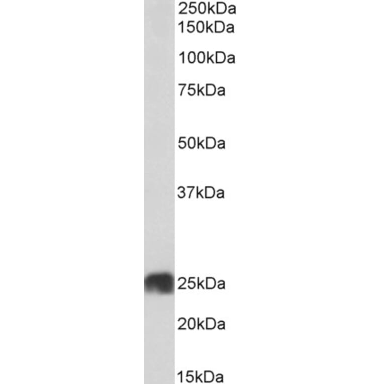 Western Blot - Anti-ATP5F1 Antibody (A85201) - Antibodies.com