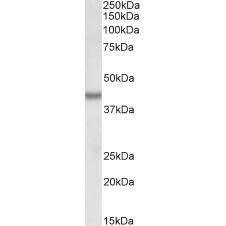 Western Blot - Anti-Bmi1 Antibody (A85202) - Antibodies.com