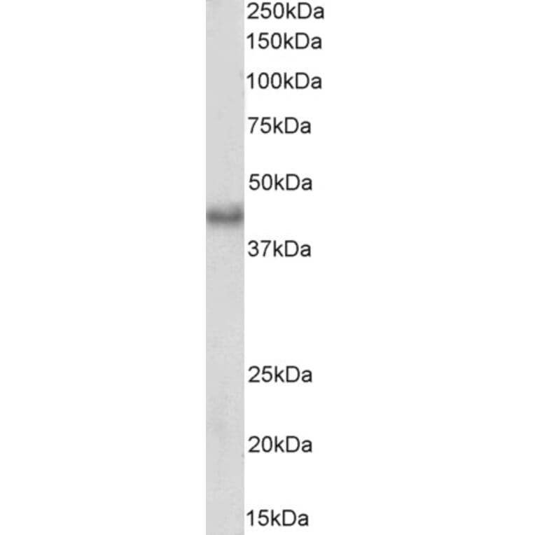 Western Blot - Anti-Bmi1 Antibody (A85202) - Antibodies.com