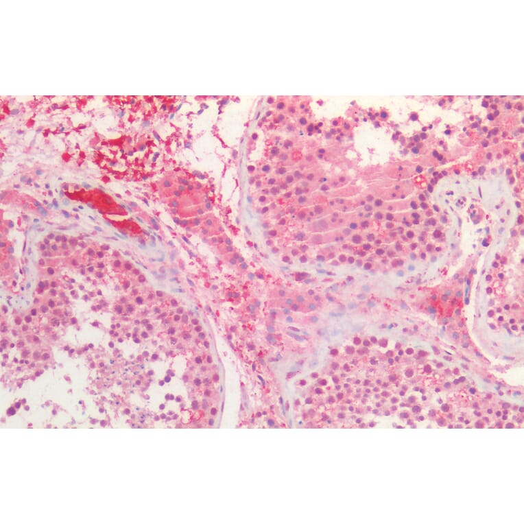 Immunohistochemistry - Anti-Bmi1 Antibody (A85202) - Antibodies.com