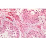 Immunohistochemistry - Anti-Bmi1 Antibody (A85202) - Antibodies.com