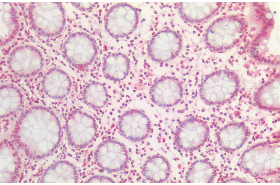 Immunohistochemistry - Anti-Bmi1 Antibody (A85203) - Antibodies.com