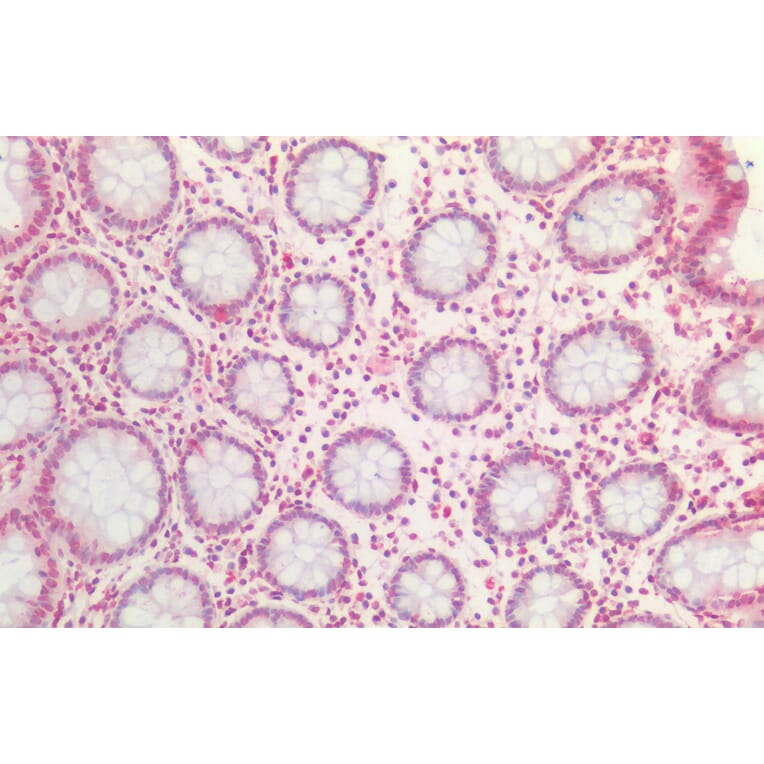 Immunohistochemistry - Anti-Bmi1 Antibody (A85203) - Antibodies.com
