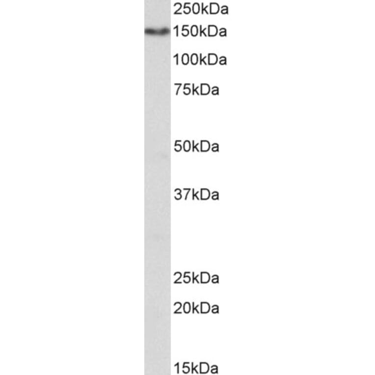 Western Blot - Anti-CD13 Antibody (A85207) - Antibodies.com