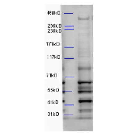 Western Blot - Anti-WDFY3 Antibody (A85210) - Antibodies.com