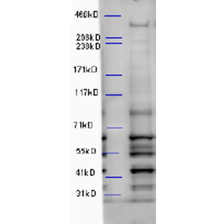 Western Blot - Anti-WDFY3 Antibody (A85210) - Antibodies.com