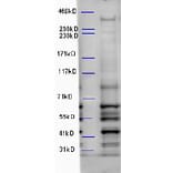 Western Blot - Anti-WDFY3 Antibody (A85210) - Antibodies.com