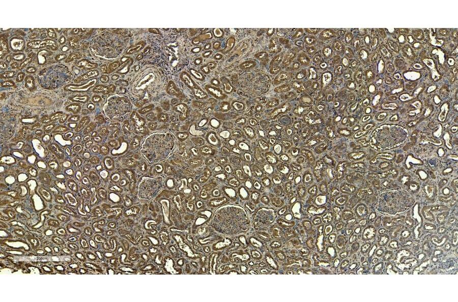 Immunohistochemistry - Anti-Fc epsilon RI/FCER1A Antibody (A85211) - Antibodies.com