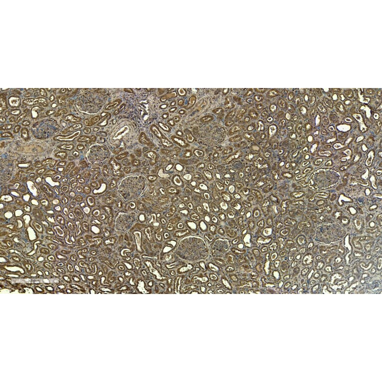 Immunohistochemistry - Anti-Fc epsilon RI/FCER1A Antibody (A85211) - Antibodies.com
