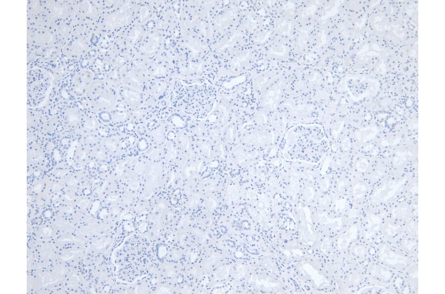 Immunohistochemistry - Anti-Fc epsilon RI/FCER1A Antibody (A85211) - Antibodies.com