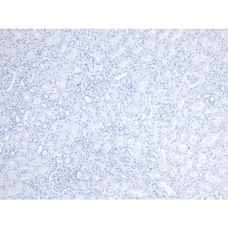 Immunohistochemistry - Anti-Fc epsilon RI/FCER1A Antibody (A85211) - Antibodies.com