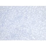 Immunohistochemistry - Anti-Fc epsilon RI/FCER1A Antibody (A85211) - Antibodies.com