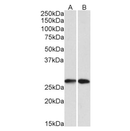 Western Blot - Anti-NNMT Antibody (A85214) - Antibodies.com