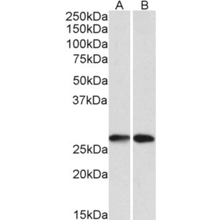 Western Blot - Anti-NNMT Antibody (A85214) - Antibodies.com