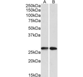 Western Blot - Anti-NNMT Antibody (A85214) - Antibodies.com