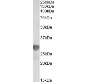 Western Blot - Anti-NNMT Antibody (A85215) - Antibodies.com