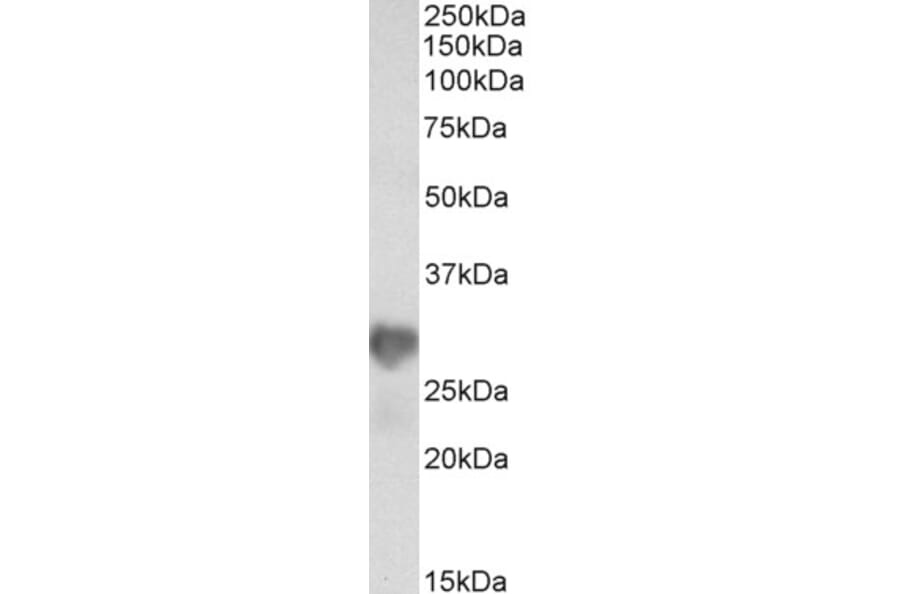 Western Blot - Anti-NNMT Antibody (A85215) - Antibodies.com