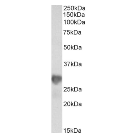 Western Blot - Anti-NNMT Antibody (A85215) - Antibodies.com
