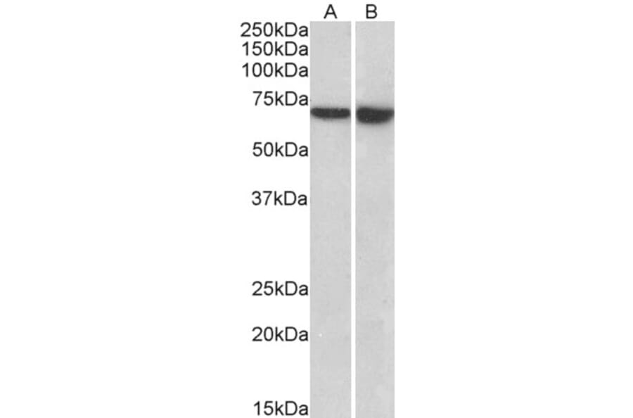 Western Blot - Anti-L Plastin Antibody (A85216) - Antibodies.com