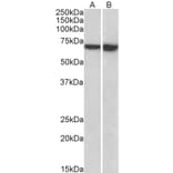 Western Blot - Anti-L Plastin Antibody (A85216) - Antibodies.com