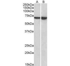 Western Blot - Anti-LCP1 Antibody (A85216) - Antibodies.com
