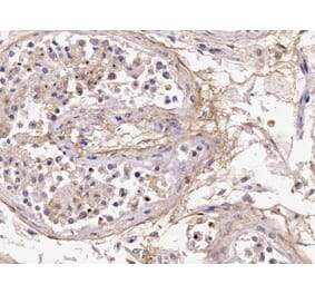 Immunohistochemistry - Anti-Acrosin Antibody (A85217) - Antibodies.com