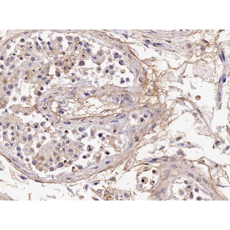 Immunohistochemistry - Anti-Acrosin Antibody (A85217) - Antibodies.com