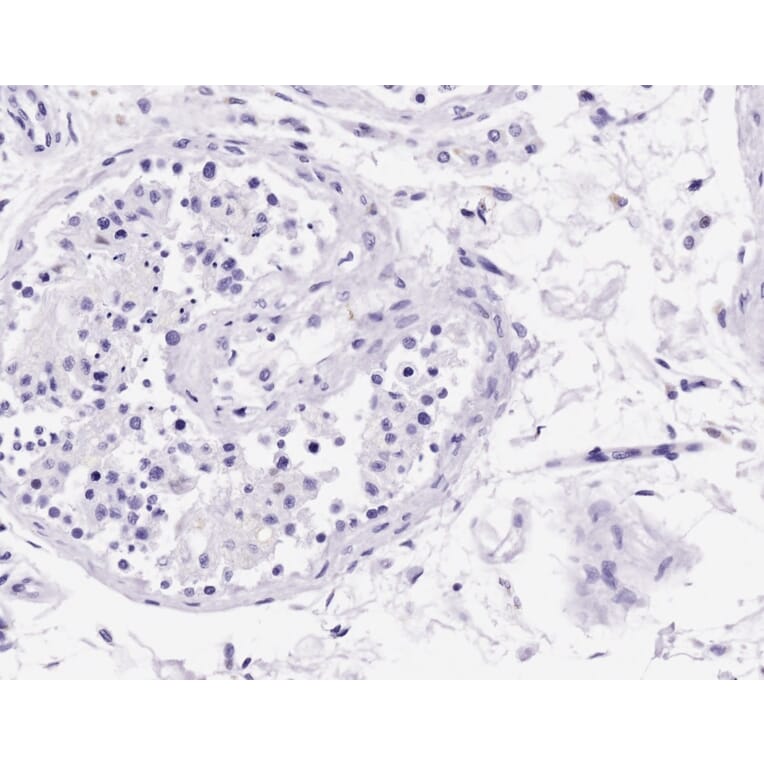 Immunohistochemistry - Anti-Acrosin Antibody (A85217) - Antibodies.com