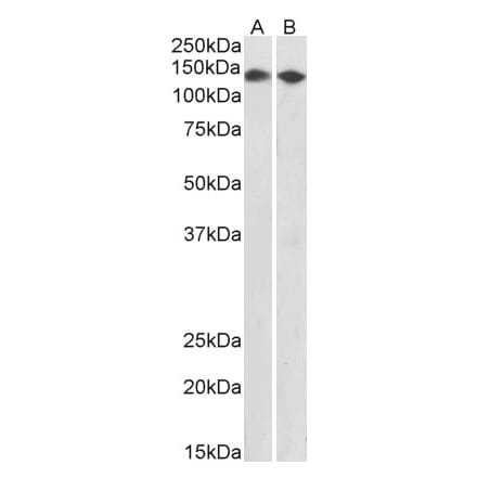 Western Blot - Anti-DBC-1 Antibody (A85218) - Antibodies.com